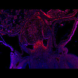 LGALS1 gene expression in a CS16 human embryonic heart